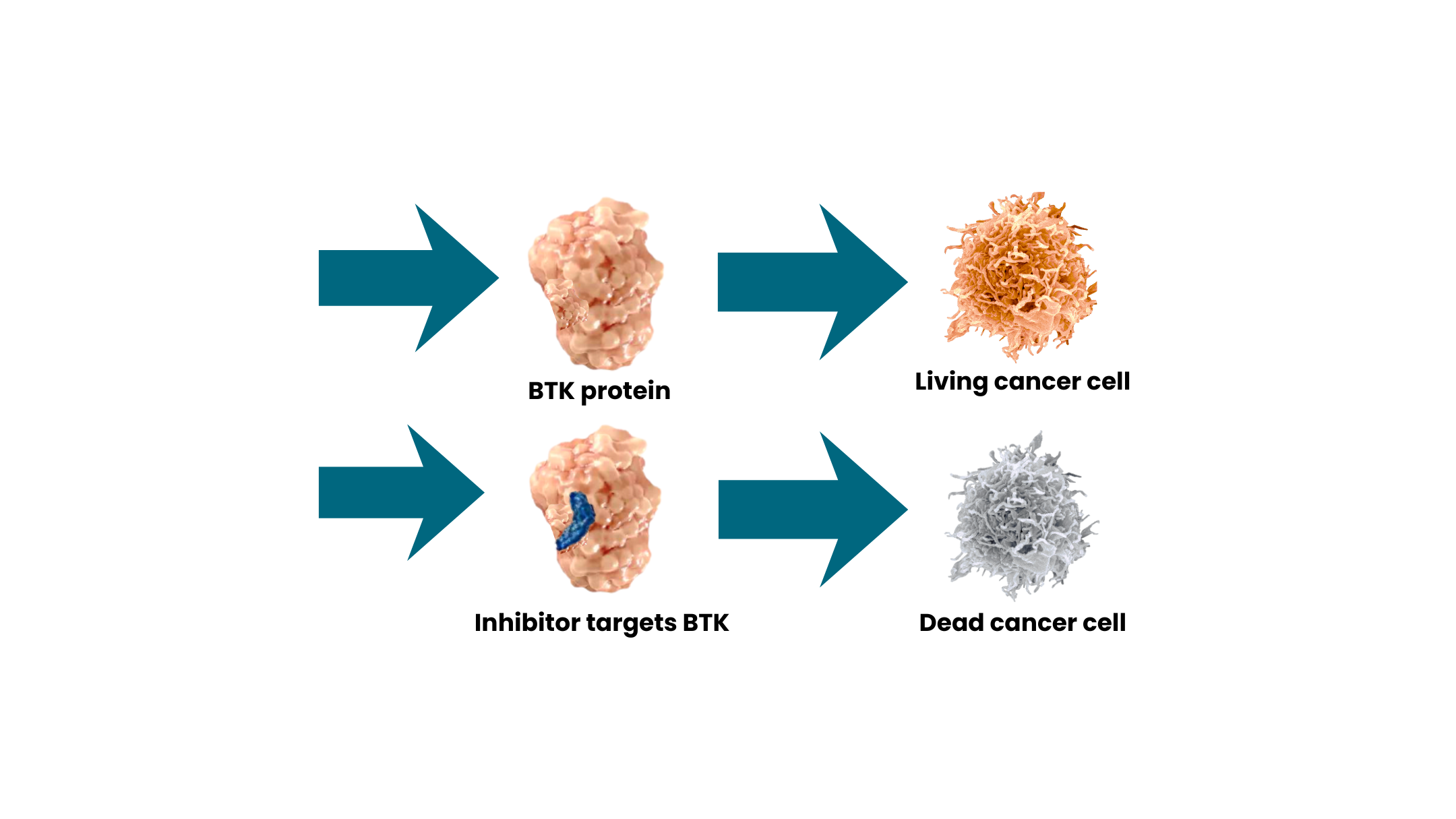 Illustration explaining how BTK inhibitors disrupt cancer cell signaling in blood cancers
